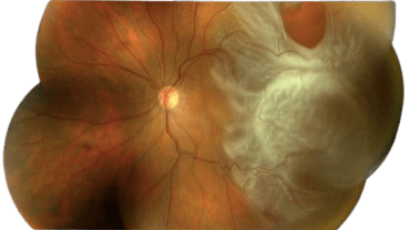 Orbit & Oculoplasty
