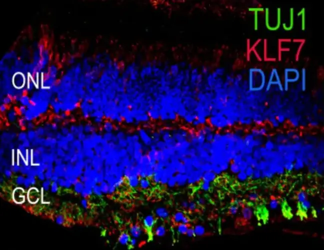 Scientists construct a first single-cell atlas of human, porcine eyes maps genes involved in eye disorders